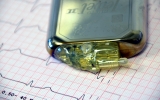 „Za kółkiem z ICD” - Bezpieczny kierowca z kardiowerterem-defibrylatorem