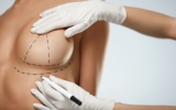 Fakty i mity nt. operacji plastycznych biustu